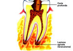 1_0002-endodonzia2_dentista_centra_mestre-150x105