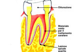 1_0003-endodonzia3_dentista_centra_mestre-150x105