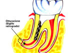1_0005-endodonzia5_dentista_centra_mestre-150x105