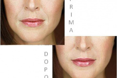 1_0002-estetica.viso5_dentista_centra_mestre