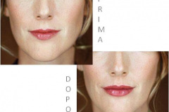 1_0003-estetica.viso6_dentista_centra_mestre