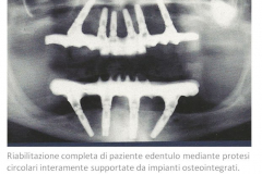 1_0003-implantologia5_dentista_centra_mestre