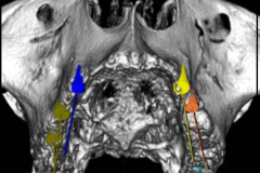 1_0004-implantologia6_dentista_centra_mestre