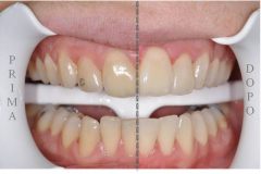 1_0001-estetica2_dentista_centra_mestre