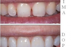 1_0002-estetica3_dentista_centra_mestre