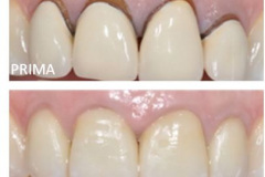 1_0003-estetica4_dentista_centra_mestre