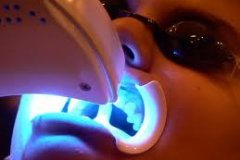 1_estetica1s_dentista_centra_mestre