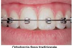 1_0001-ortotradizionale1_dentista_centra_mestre