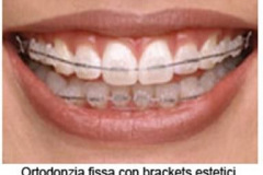 1_0002-ortotradizionale2_dentista_centra_mestre