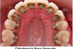 1_0003-ortotradizionale3_dentista_centra_mestre