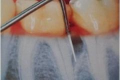 1_0002-parodontologia2_dentista_centra_mestre