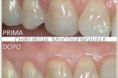 1_0003-parodontologia3_dentista_centra_mestre