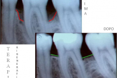 1_0004-parodontologia4_dentista_centra_mestre