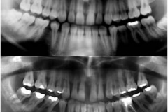 1_0005-parodontologia5_dentista_centra_mestre