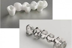 1_0002-protesi2_dentista_centra_mestre