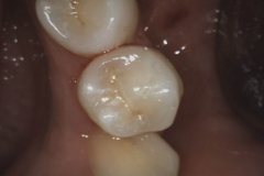 1_videocamera-endorale-2