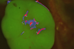 1_videocamera-endorale-3